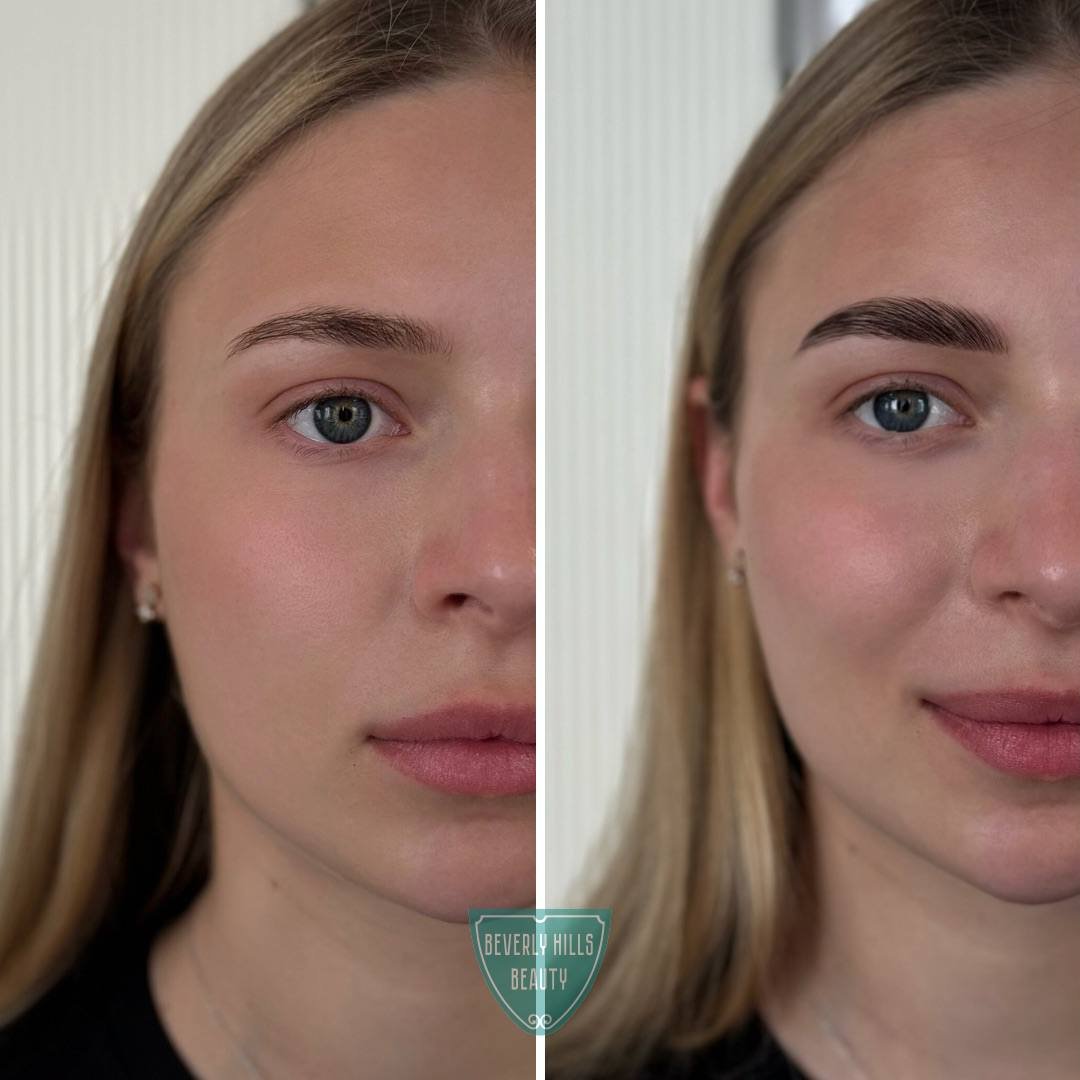 Massage in Vienna - Beverly Hills Beauty